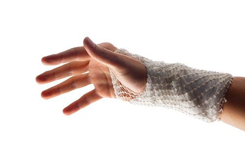 Schlauch und Netzverband am Handgelenk Netzverband wird um ein Handgelenk getragen