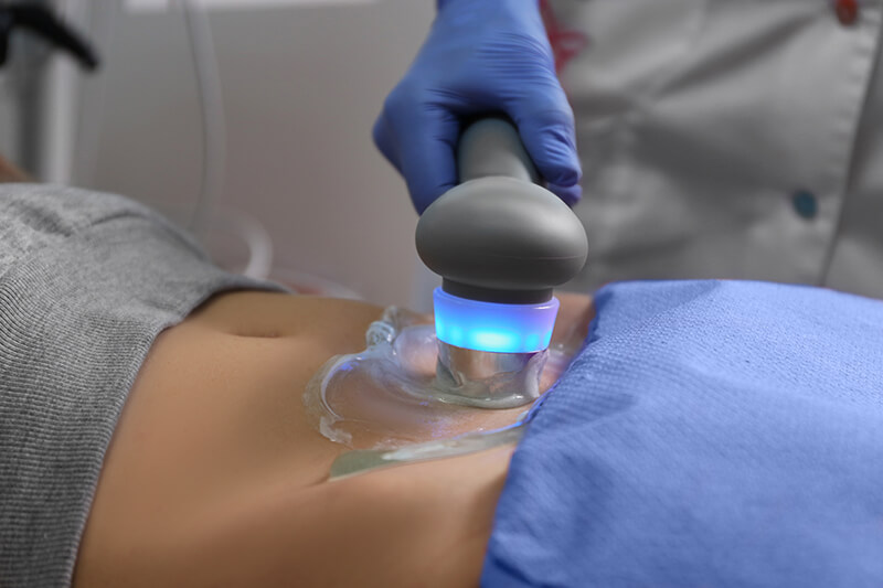 Eine Person nutzt das Ultraschallgel im Cubitainer 5l
