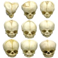Erler Zimmer Fetusschädel Anatomie Modell, versch....