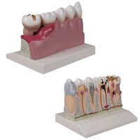 Dentalmodell von Erler Zimmer, Unterkiefer Zahn 3 -7,...