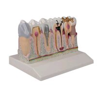 Dentalmodell von Erler Zimmer, Unterkiefer Zahn 3 -7,...