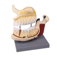 Ober- und Unterkiefermodell von Erler Zimmer, nummeriert,...