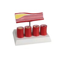 Erler Zimmer Arterienmodell, 4 Schnitte, Verengungen...