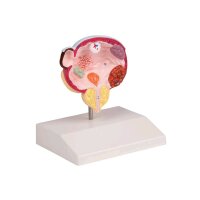 Erler Zimmer Blasen- und Prostata-Modell, 5 Pathologien,...