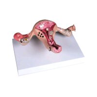Erler Zimmer Uterusmodell mit Erkrankungen,...