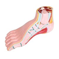 Erler Zimmer Hohlfuß-Modell, medial geöffnet,...