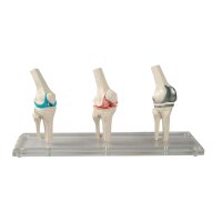 Erler Zimmer Knie-Implantat-Modell, 3 Stck,...