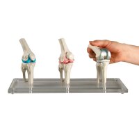 Erler Zimmer Knie-Implantat-Modell, 3 Stck,...