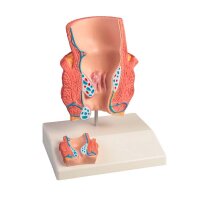 Erler Zimmer Tischmodell - Hämorrhoiden, 2-fache...