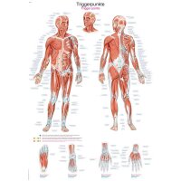 Erler Zimmer anatomische Lehrtafel - Triggerpunkte, 2...